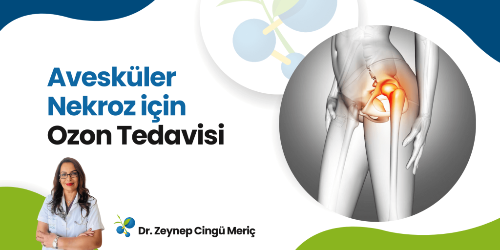 Avesküler Nekroz İçin Ozon Tedavisinin Faydaları