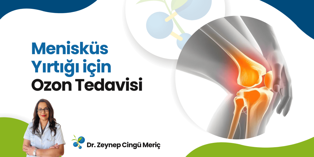 Menisküs Yırtığı Tedavisinde Ozon Tedavisinin Faydaları 1 Menisküs Yırtığı Tedavisinde Ozon Tedavisinin Faydaları